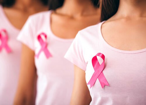 Breast cancer originates in the breast tissues,