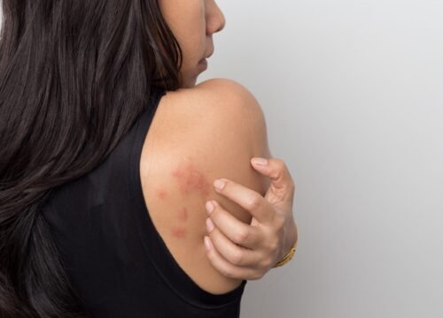 Skin cancers are the most common type of cancer