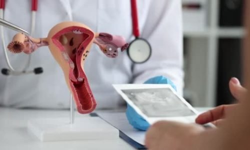 Cervical Cancer – Causes, Symptoms, Prevention & Treatment